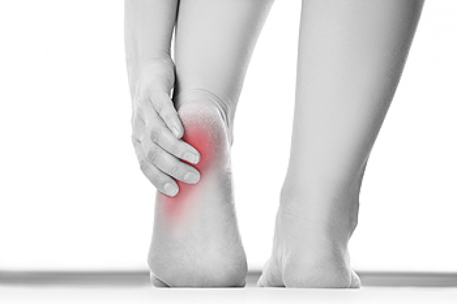 Causes of heel deals pain in runners